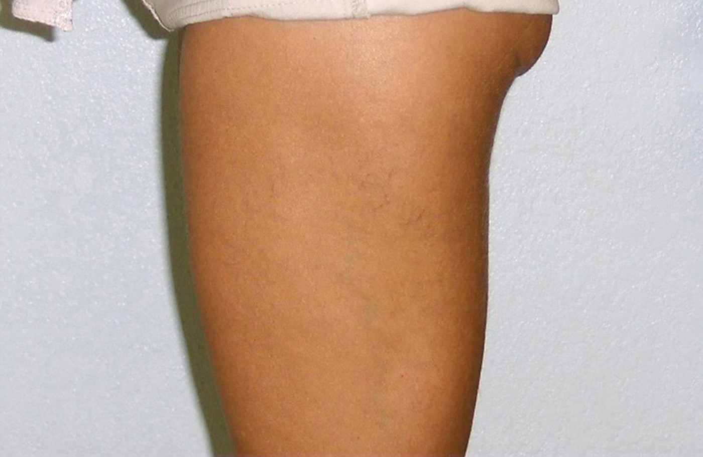 After image