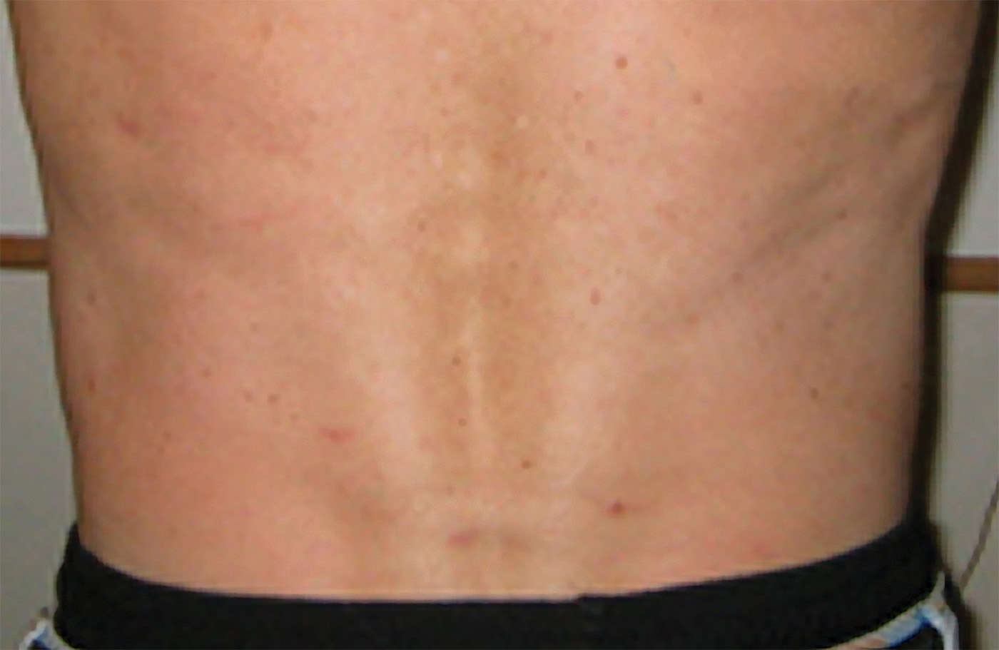 BRIAN waist after 72res
