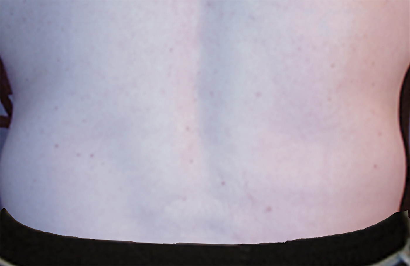 BRIAN waist before 72res