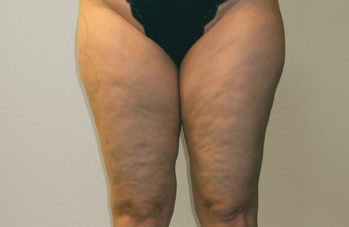 KAMINSKI legs before 72res