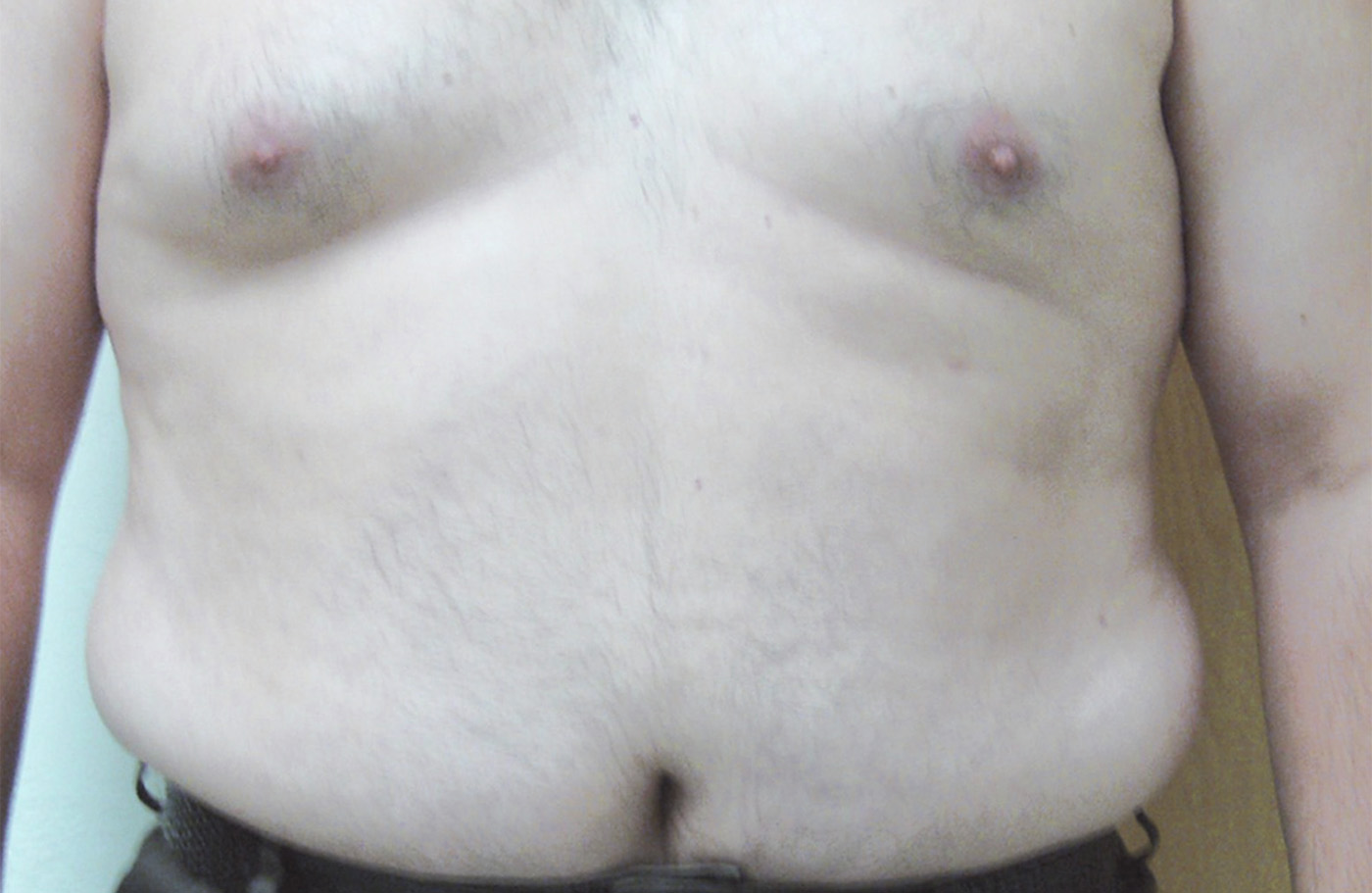 Before image