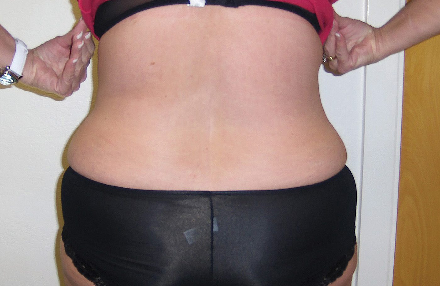 WOMAN2 waist after 72res