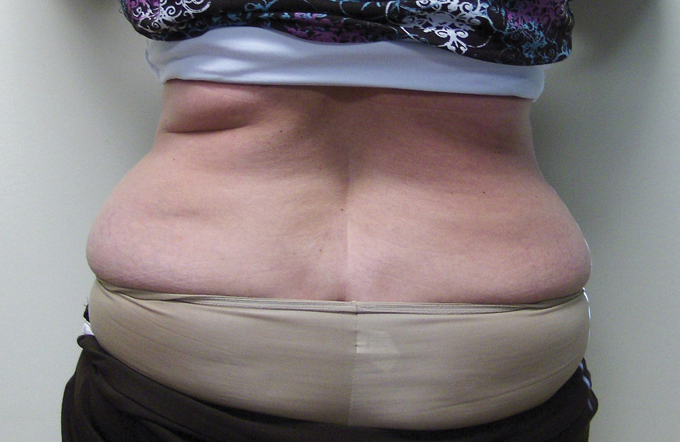 WOMAN2 waist before 72res