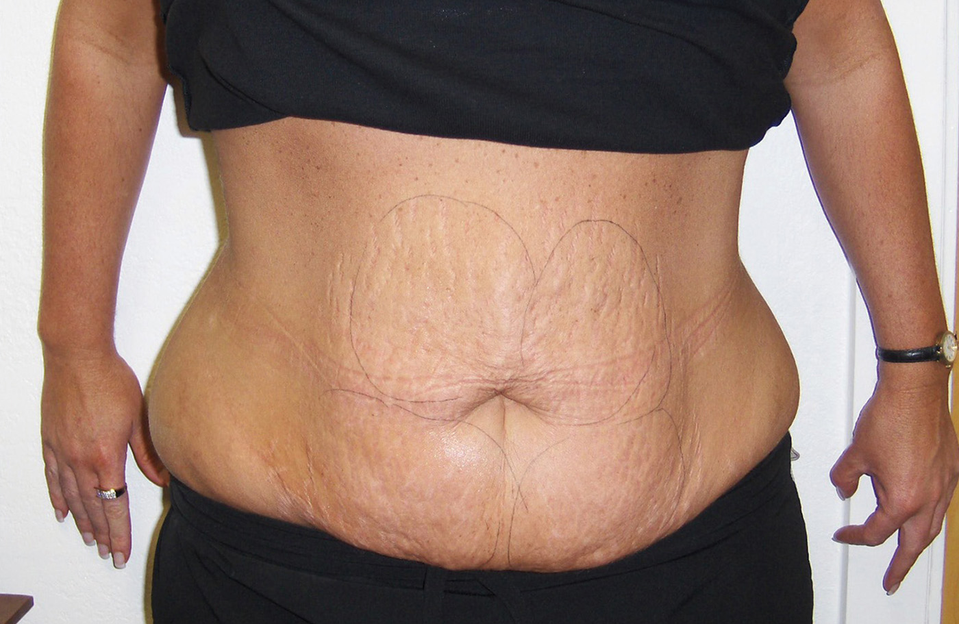 WOMAN3 waist before 72res